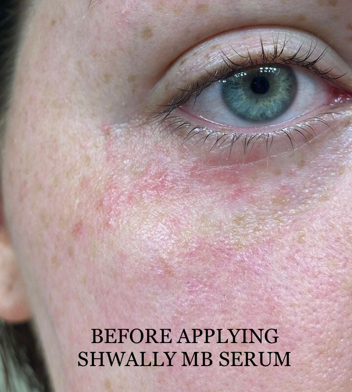 Shwally Methylene Blue Repair Serums