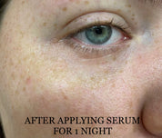 Shwally Methylene Blue Repair Serums