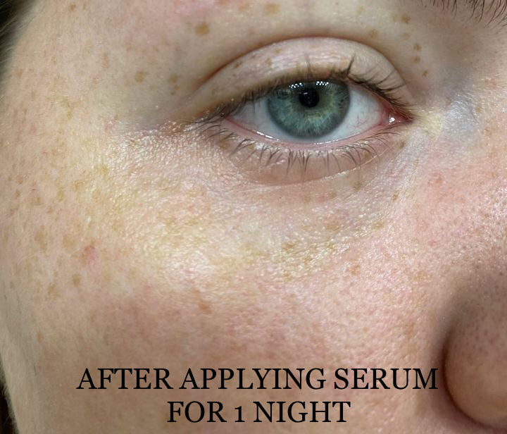 Shwally Methylene Blue Repair Serums