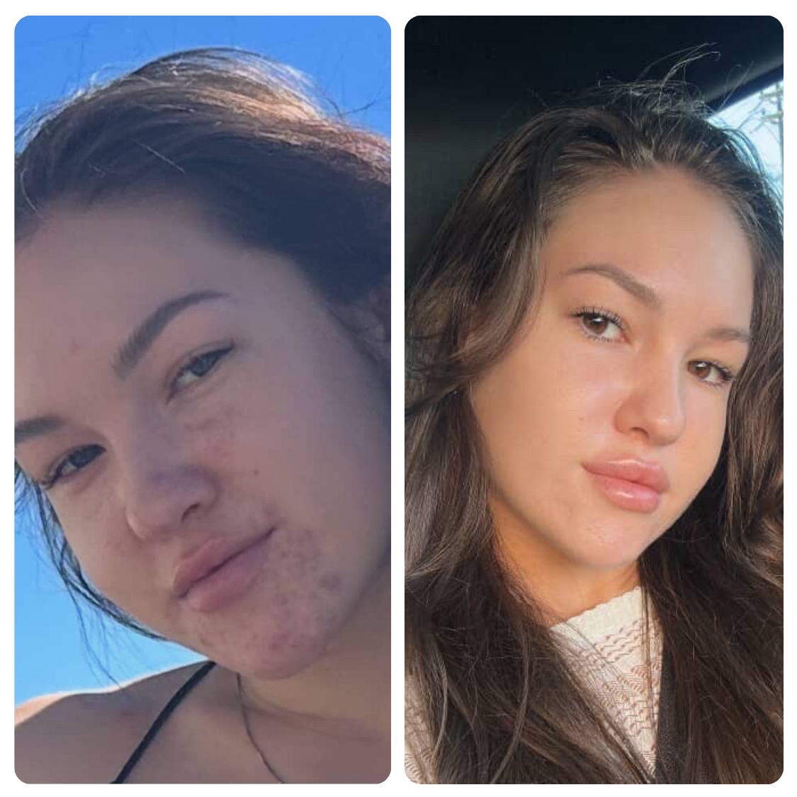 Repair Serum (High Potency)